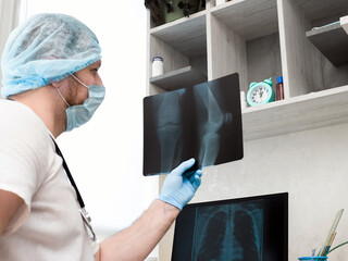 Doctor radiographer, with a stethoscope, in a medical uniform in a clinic, a traumatologist analyzes a broken leg. X-ray of the knee. Ultrasound. Injury of the leg in the knee joint. Osteoporosis