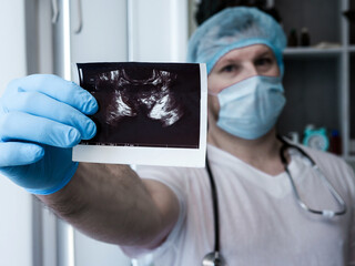 Adenoma prostate cancer in doctor's hands. The doctor diagnoses an ultrasound of prostate adenoma in a man in the clinic. The urologist studies the disease of the genitourinary system