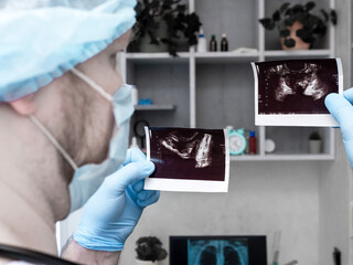 The doctor diagnoses an ultrasound of prostate adenoma in a man in the clinic. A urologist studies...