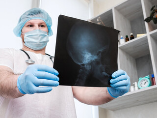 Human skull on x-ray in doctor's hands. Doctor in the office studying diseases of the central and...