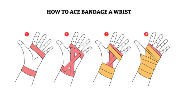 Set of how to ace bandage a wrist step by step guide infographic poster design, sprained hands with elastic bandage and ankle support treatments, Pain, hip, ortho, anatomy, body, care concept.