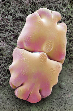 Euastrum desmid, SEM