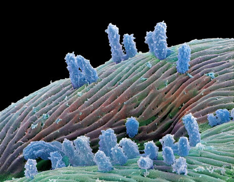 Stagnant water bacteria, SEM