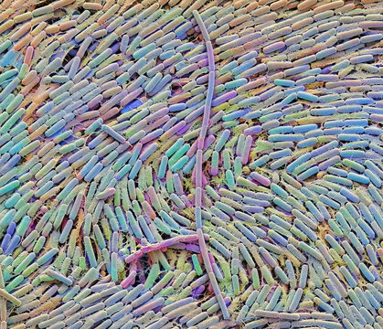 Breast milk bacteria