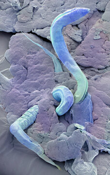 C. elegans, SEM
