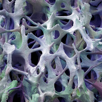 Bone tissue, SEM