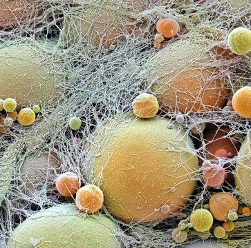 Fat cells, SEM