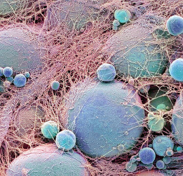 Fat cells, SEM