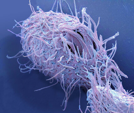 Fresh water ciliate protozoan, SEM