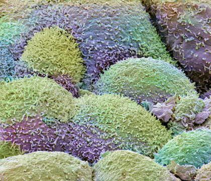 Human prostate. SEM
