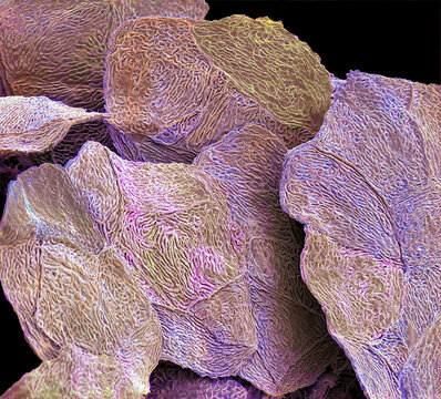Skin cells, SEM