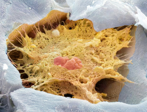 Osteocyte, SEM