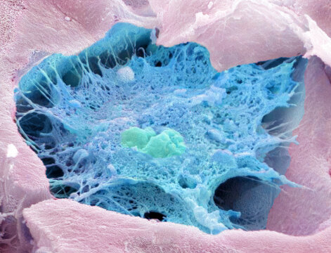Osteocyte, SEM