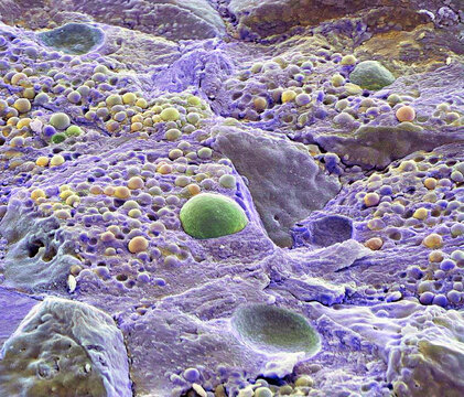 Pancreas tissue, SEM