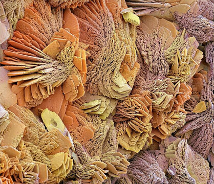 Limescale, SEM