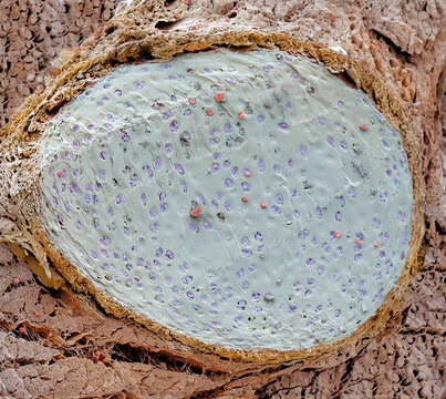 Rib fracture, SEM