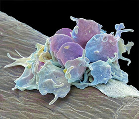 Activated platelets, SEM