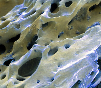 Fossilised dinosaur bone, SEM