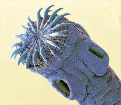 Pork tapeworm, SEM
