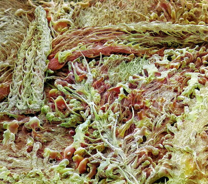 Cannabis plant, SEM
