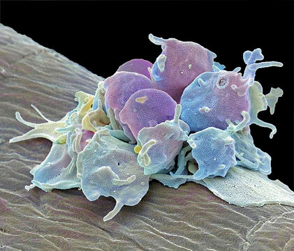 Activated platelets, SEM