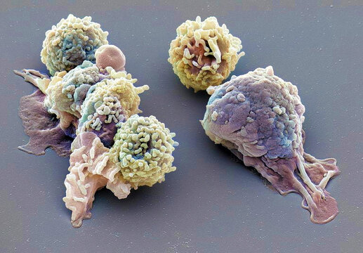 Granulocytes, SEM