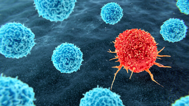 Tumour infiltrating lymphocyte therapy, illustration