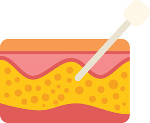 Medical concept of anti aging treatment showing cross section of skin being injected with hyaluronic acid