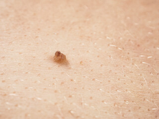 Close-up of skin showing texture and structure, highlighting details important to the study of dermatology