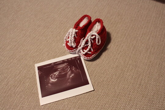 Schwangerschaft, Babybauch, baby, liebe, frau, eltern, familie, close up, ultraschall, Fotografie, freude, schuhe, kinder, gl&uuml;ck, babygl&uuml;ck, bauch, sch&ouml;n, s&uuml;&szlig;, ideen, shooting, fotoshooting, 