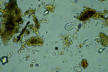 soil fungi storing carbon in the soil. testate amoebae and bacteria cycling nutrients. regenerative agriculture sustainable practices growing healthy food on farms and in crops