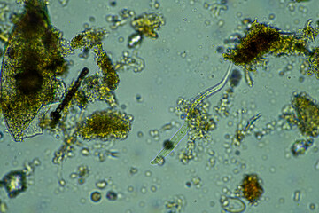 soil fungi storing carbon in the soil. testate amoebae and bacteria cycling nutrients. regenerative agriculture sustainable practices growing healthy food on farms and in crops