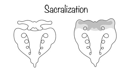 Sacralization