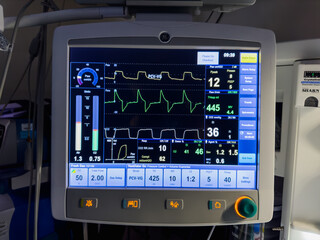 hospital monitors displaying vital signs, including heart rate, oxygen levels, and blood pressure. Represents the precision and urgency of medical care, life monitoring, and patient well-being