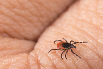 Female deer tick parasite crawling on human fingers skin background. Ixodes ricinus. Close-up of parasitic insect mite. Danger of tick-borne diseases transmission as encephalitis and Lyme borreliosis.