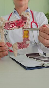 Doctor explains human digestive system with anatomical model during patient consultation on digestive health