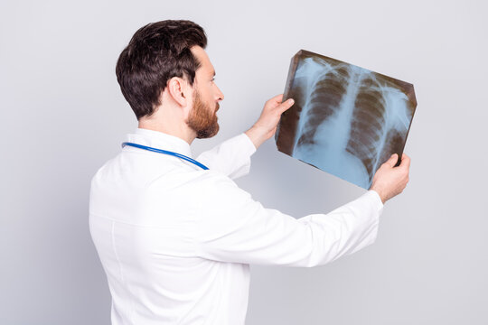 Photo of handsome doctor paramedic wear white coat watching xray scan fluorography picture lungs isolated on grey color background