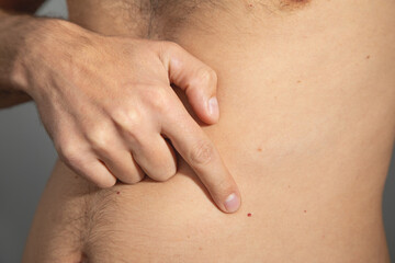 Red dots on the human body.