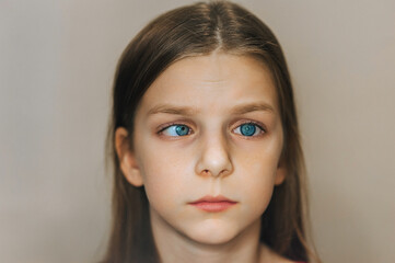 Photograph, portrait close-up of blue-eyed sick sad cross-eyed little girl face, child with health problems. Concept, disease strabismus.