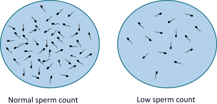 Low sperm count and normal sperm count vector illustration