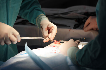 Surgical intervention in the abdominal cavity through the navel. Laparoscopy in surgery.Surgeon's...