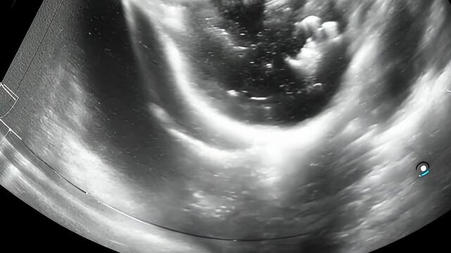 Ultrasound Scan of a Baby Fetus During Pregnancy: Medical Imaging in Obstetrics and Gynecology