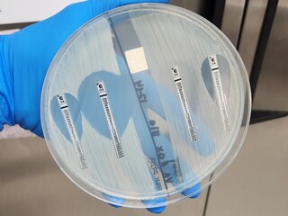 Methicillin sensitive and resistant staphylococcal isolates - E-test