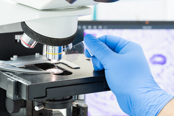 Scientist wear blue glove holding parafin human tissue block and out of focus microscope and...