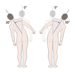 흉요추 관절 정상 운동 범위 일러스트