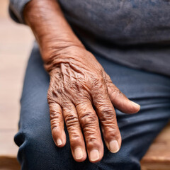 Fototapeta premium Mano di una donna anziana con artrite