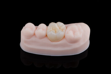 High-quality single dental crown with naturally morphology made of multilayer zirconia for upper jaw © gorynvd