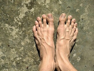 A pair of human feet exposed to sunlight