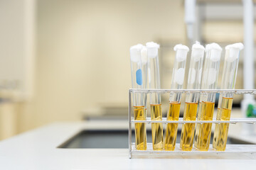 MPN coliform E.Coli testing: The most probable number (MPN) technique is a method for estimating the number of bacteria in a food or water sample in laboratory.