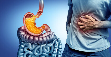 Heartburn And Acid Reflux or Gastroesophageal disease or GERD as an open sphincter with an iflammed esophagus as regurgitation and a burning in the chest